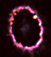 SN 1987A